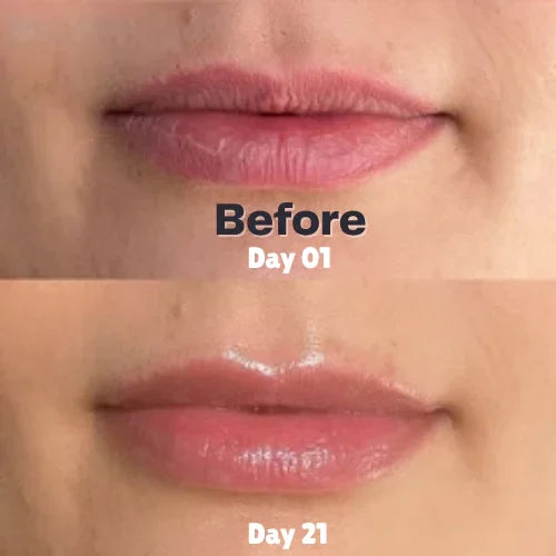 Lip Balm
