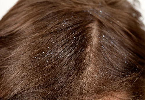 REASONS WHY AVOCADO OIL FOR HAIR IS BECOMING THE TALK OF THE TOWN on satliva.com