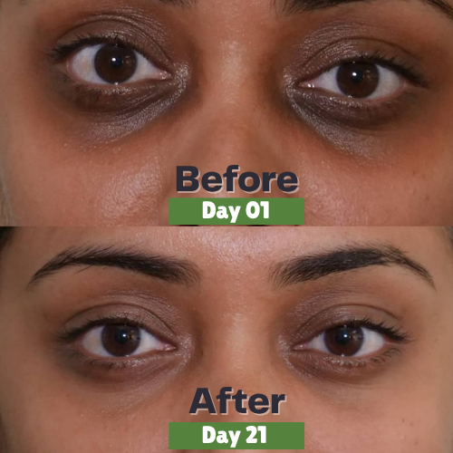 Natural Skin Care