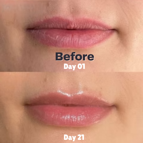 Lip Balm