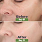 Natural Skin Care
