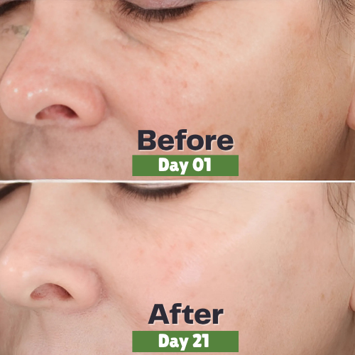 Natural Skin Care