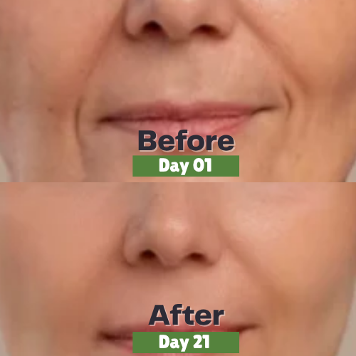 Face Cream